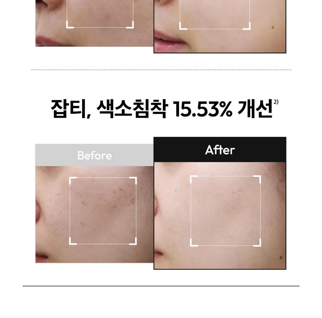 [기미잡티세럼] 레이어랩 기미흔적 클리어 세럼 30ml 상세페이지 18